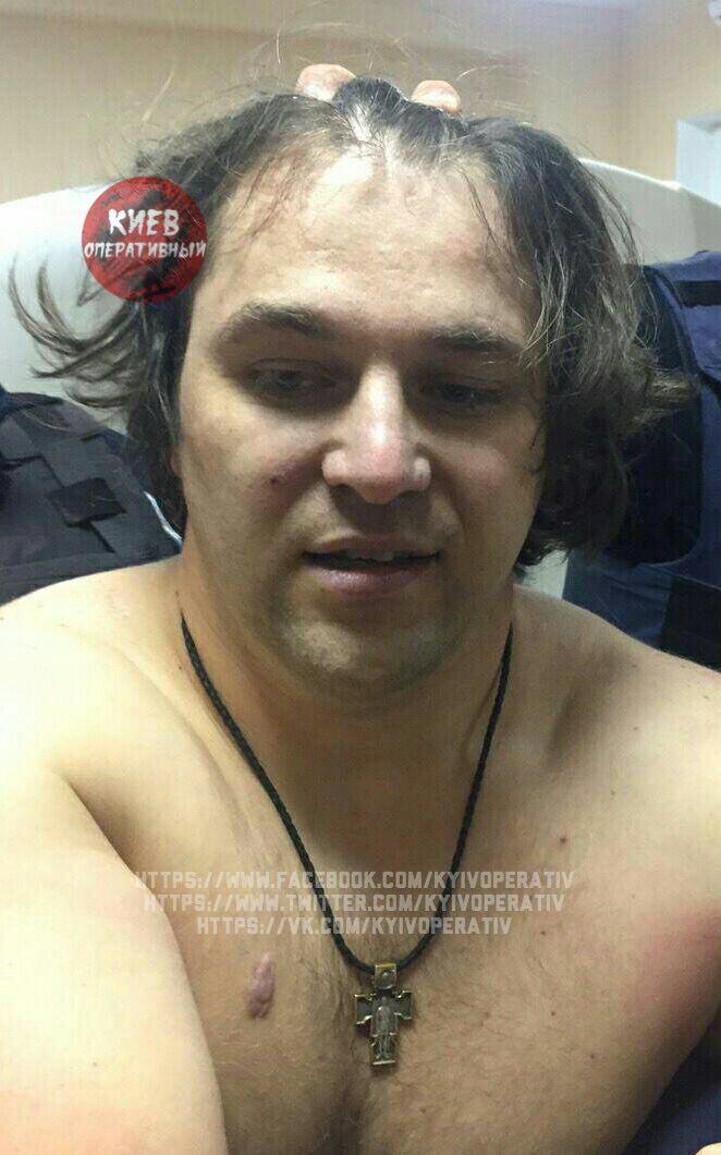 Suspected killer was detained in Mechnikova hospital of Dnipro. He was wounded