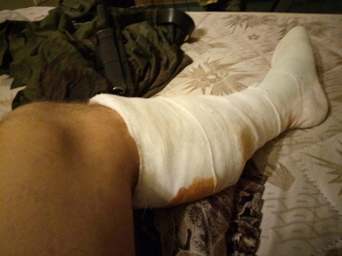 Mercenary sniper from Serbia Deyan Deki Berich was wounded at Donbas