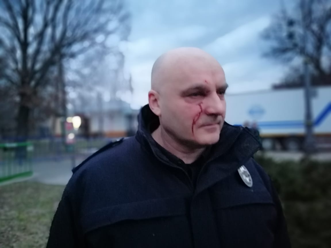 15 policemen wounded in clashes in Cherkasy